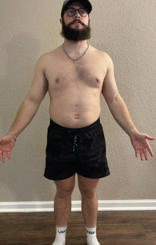 RICHIE before