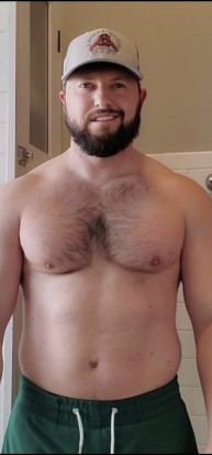 MATT R. before